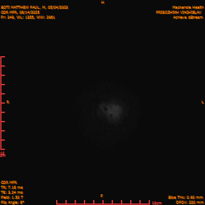 2025-06-14/COR_MPR/0250-IM595.png