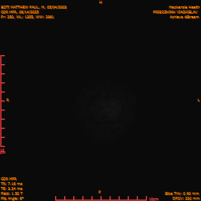 2025-06-14/COR_MPR/0251-IM596.png