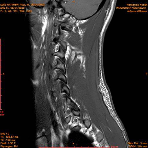 2025-06-14/SAG T1/0001-.png