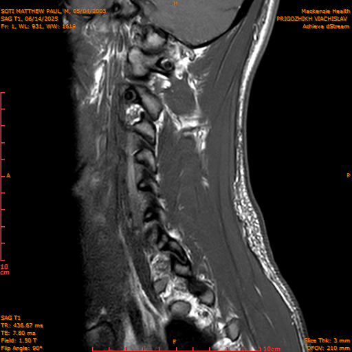 2025-06-14/SAG T1/0002-.png