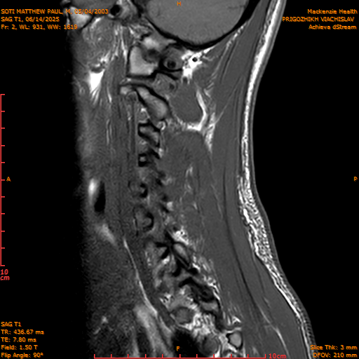 2025-06-14/SAG T1/0003-.png