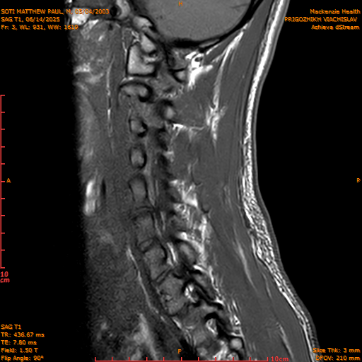 2025-06-14/SAG T1/0004-.png