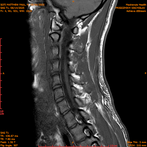 2025-06-14/SAG T1/0005-.png