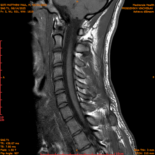 2025-06-14/SAG T1/0006-.png