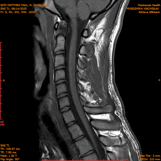 2025-06-14/SAG T1/0007-.png
