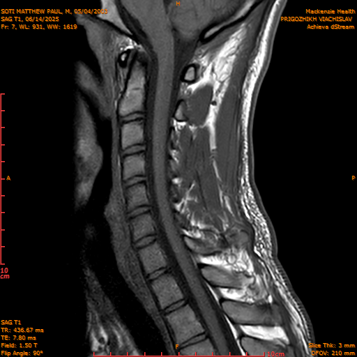 2025-06-14/SAG T1/0008-.png
