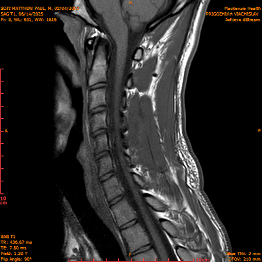 2025-06-14/SAG T1/0009-.png