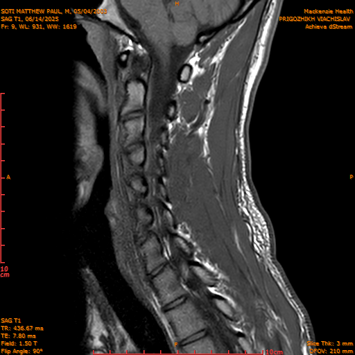 2025-06-14/SAG T1/0010-.png