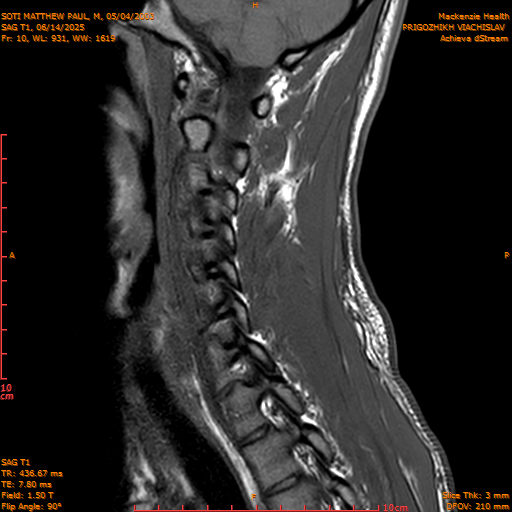 2025-06-14/SAG T1/0011-.png