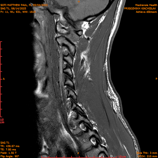 2025-06-14/SAG T1/0012-.png