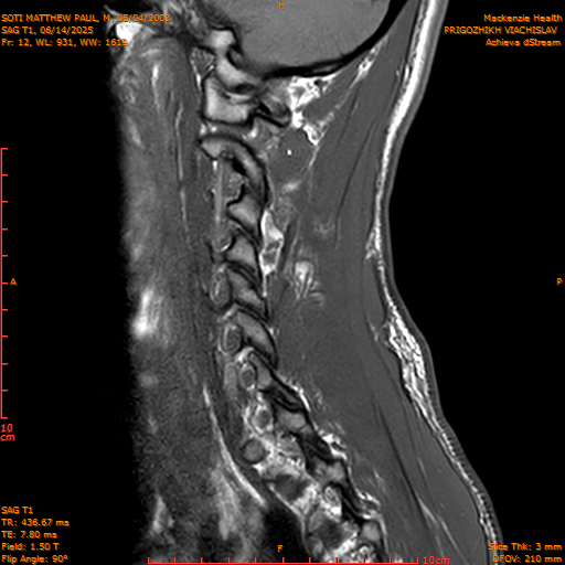2025-06-14/SAG T1/0013-.png