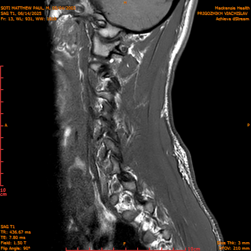 2025-06-14/SAG T1/0014-.png