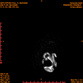 2025-06-14/SAG T1 3D/0001-IM186.png