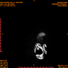 2025-06-14/SAG T1 3D/0002-IM187.png