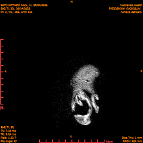 2025-06-14/SAG T1 3D/0003-IM188.png
