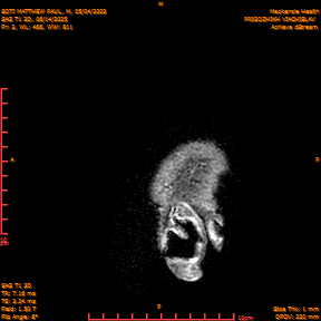 2025-06-14/SAG T1 3D/0004-IM189.png