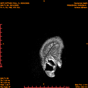 2025-06-14/SAG T1 3D/0005-IM190.png
