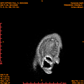 2025-06-14/SAG T1 3D/0006-IM191.png