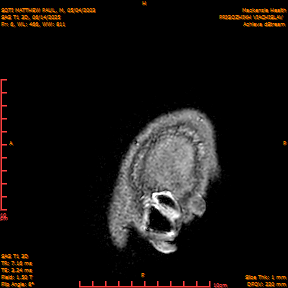 2025-06-14/SAG T1 3D/0007-IM192.png