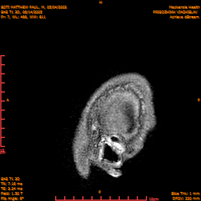 2025-06-14/SAG T1 3D/0008-IM193.png