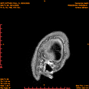 2025-06-14/SAG T1 3D/0009-IM194.png