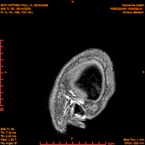 2025-06-14/SAG T1 3D/0010-IM195.png