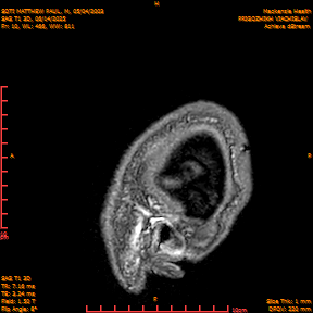 2025-06-14/SAG T1 3D/0011-IM196.png