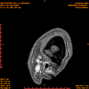 2025-06-14/SAG T1 3D/0012-IM197.png