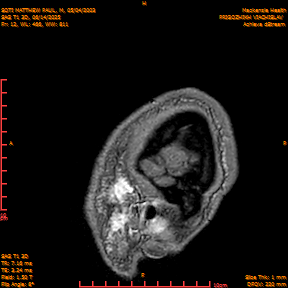 2025-06-14/SAG T1 3D/0013-IM198.png
