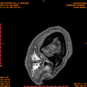 2025-06-14/SAG T1 3D/0014-IM199.png
