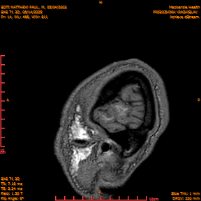 2025-06-14/SAG T1 3D/0015-IM200.png