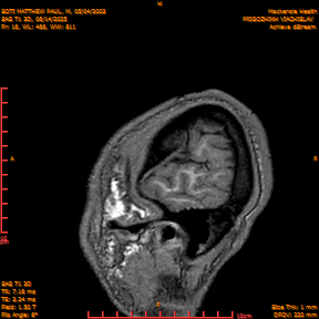 2025-06-14/SAG T1 3D/0017-IM202.png