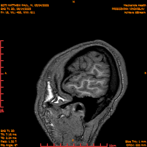 2025-06-14/SAG T1 3D/0019-IM204.png