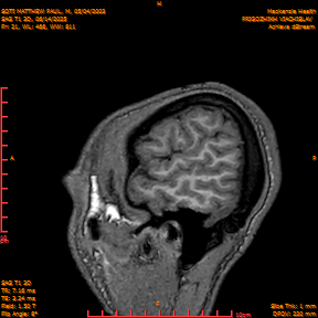 2025-06-14/SAG T1 3D/0022-IM207.png