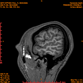 2025-06-14/SAG T1 3D/0023-IM208.png