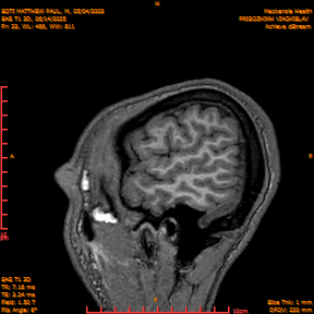 2025-06-14/SAG T1 3D/0024-IM209.png