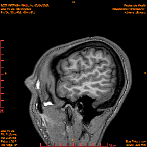 2025-06-14/SAG T1 3D/0025-IM210.png