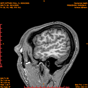 2025-06-14/SAG T1 3D/0026-IM211.png