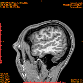 2025-06-14/SAG T1 3D/0027-IM212.png