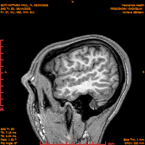 2025-06-14/SAG T1 3D/0028-IM213.png