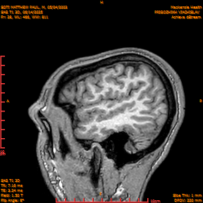 2025-06-14/SAG T1 3D/0029-IM214.png