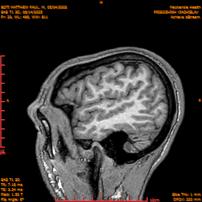 2025-06-14/SAG T1 3D/0030-IM215.png