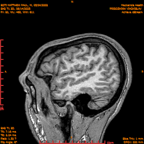 2025-06-14/SAG T1 3D/0031-IM216.png