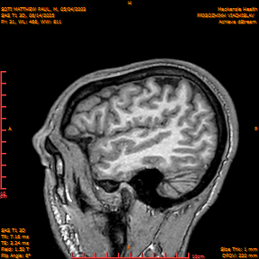 2025-06-14/SAG T1 3D/0032-IM217.png