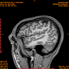 2025-06-14/SAG T1 3D/0033-IM218.png