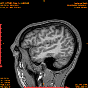 2025-06-14/SAG T1 3D/0034-IM219.png
