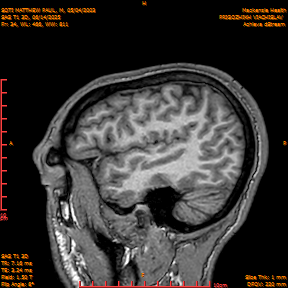 2025-06-14/SAG T1 3D/0035-IM220.png