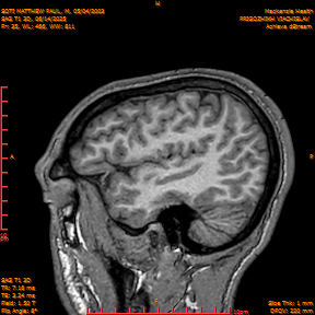 2025-06-14/SAG T1 3D/0036-IM221.png