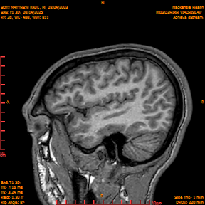 2025-06-14/SAG T1 3D/0037-IM222.png