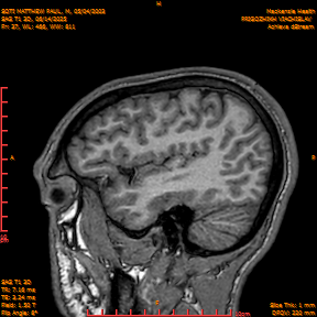 2025-06-14/SAG T1 3D/0038-IM223.png